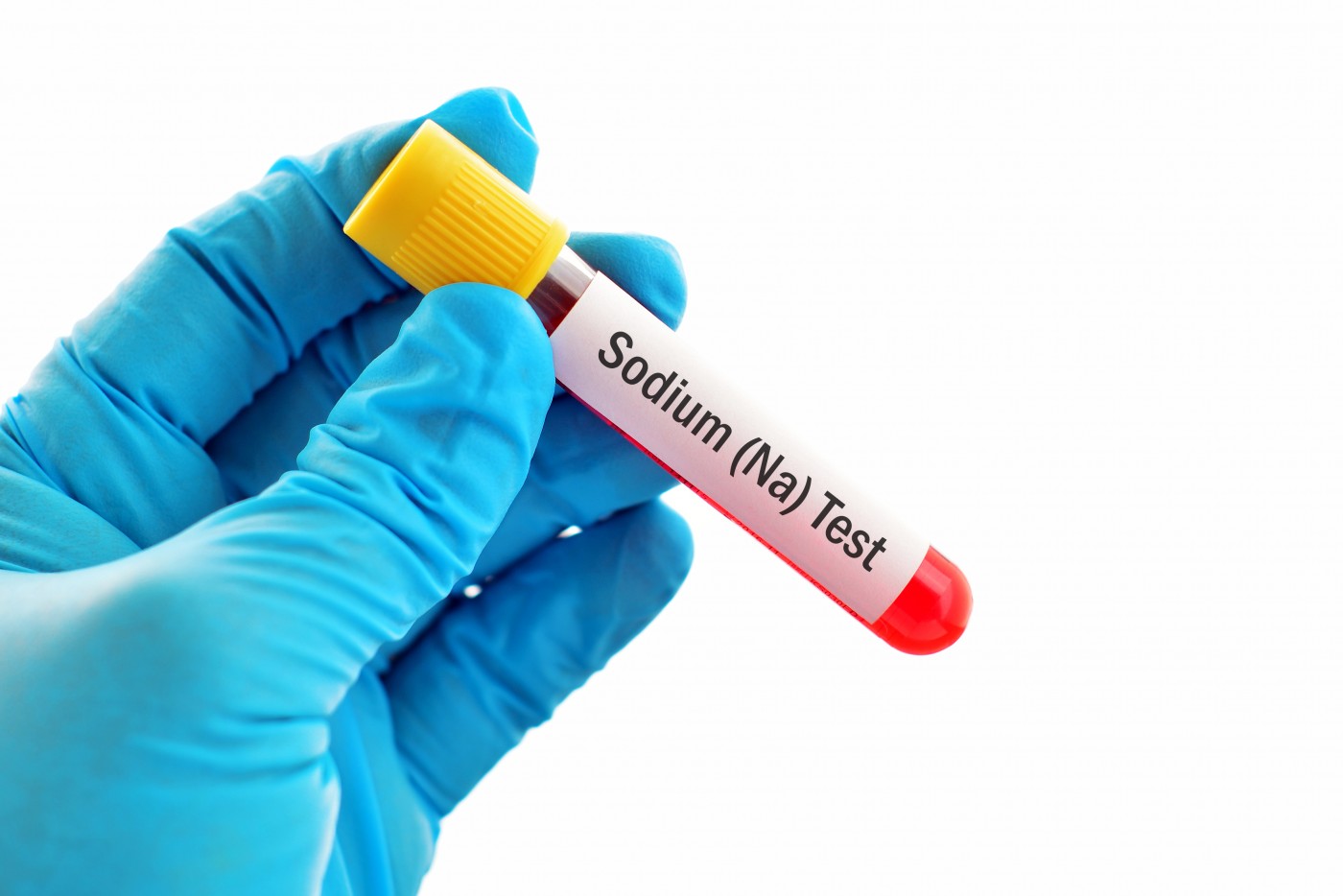 Low Sodium in Blood (Hyponatremia)- A cause of concern